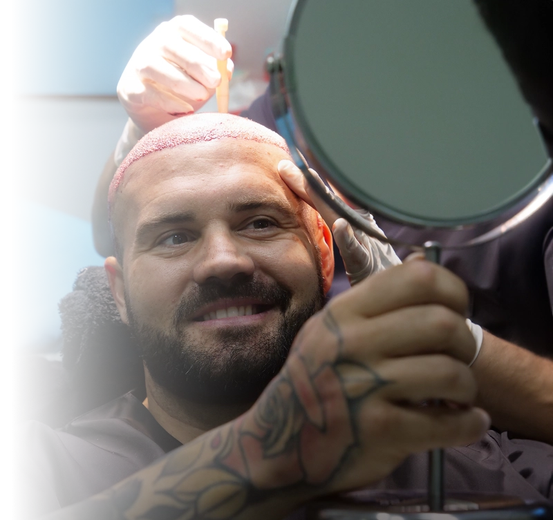 Saç Ekimi Sonrası Bakım: En İyi Uygulamalar